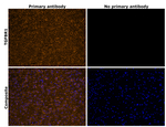 TGFBR1 Antibody in Immunohistochemistry (Paraffin) (IHC (P))