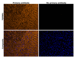 TGFBR1 Antibody in Immunohistochemistry (Paraffin) (IHC (P))