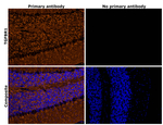 TGFBR1 Antibody in Immunohistochemistry (Paraffin) (IHC (P))