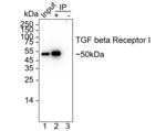TGFBR1 Antibody in Immunoprecipitation (IP)