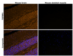 TGFBR1 Antibody