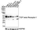 TGFBR1 Antibody in Western Blot (WB)