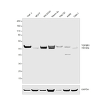TGFBR1 Antibody in Western Blot (WB)