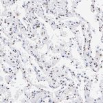 MECP2 Antibody in Immunohistochemistry (Paraffin) (IHC (P))