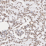MECP2 Antibody in Immunohistochemistry (Paraffin) (IHC (P))