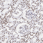 MECP2 Antibody in Immunohistochemistry (Paraffin) (IHC (P))