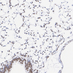 MECP2 Antibody in Immunohistochemistry (Paraffin) (IHC (P))