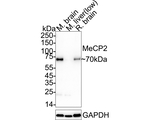 MECP2 Antibody in Western Blot (WB)
