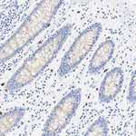 RAB27B Antibody in Immunohistochemistry (Paraffin) (IHC (P))