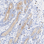 RAB27B Antibody in Immunohistochemistry (Paraffin) (IHC (P))
