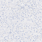 RAB27B Recombinant Rabbit Monoclonal Antibody (PSH14-68)