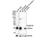 RAB27B Antibody in Western Blot (WB)