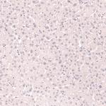 Nkx2.1 Antibody in Immunohistochemistry (Paraffin) (IHC (P))