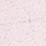 Nkx2.1 Antibody in Immunohistochemistry (Paraffin) (IHC (P))