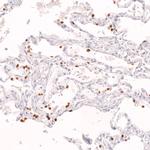 Nkx2.1 Antibody in Immunohistochemistry (Paraffin) (IHC (P))