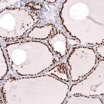 Nkx2.1 Antibody in Immunohistochemistry (Paraffin) (IHC (P))