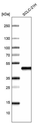 Nkx2.1 Antibody in Western Blot (WB)