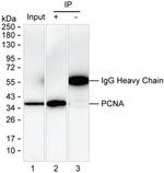 PCNA Antibody in Immunoprecipitation (IP)