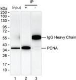 PCNA Recombinant Human Monoclonal Antibody (K29023_14A4)