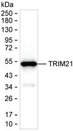 TRIM21 Recombinant Human Monoclonal Antibody (K52008_3F2)