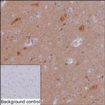 HOMER1 Recombinant Mouse Monoclonal Antibody (R35001_89F4)