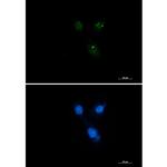 Presenilin 1 Recombinant Rabbit Monoclonal Antibody (K01_3L61)