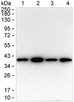 OLIG1 Recombinant Rabbit Monoclonal Antibody (K01_3L89)