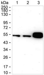 CaMKII alpha Recombinant Rabbit Monoclonal Antibody (K01_1N81)