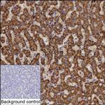 ABAT Recombinant Rabbit Monoclonal Antibody (K01_1R47)