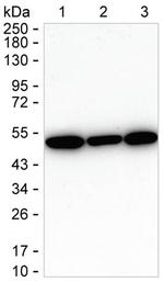 ABAT Antibody in Western Blot (WB)