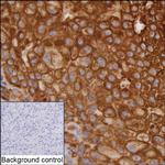 Aquaporin 1 Recombinant Rabbit Monoclonal Antibody (K01_1M96)