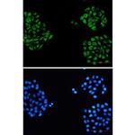 alpha Internexin Recombinant Rabbit Monoclonal Antibody (K01_2L36)