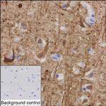 alpha Internexin Antibody in Immunohistochemistry (Paraffin) (IHC (P))