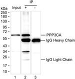 Calcineurin A Antibody in Immunoprecipitation (IP)
