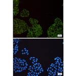 SMN1 Recombinant Rabbit Monoclonal Antibody (K01_1R61)