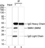 SMN1 Antibody in Immunoprecipitation (IP)