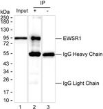 EWSR1 Antibody in Immunoprecipitation (IP)