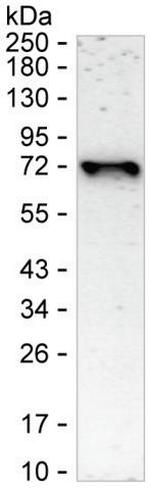 FOXC1 Recombinant Rabbit Monoclonal Antibody (K01_1R29)