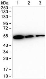 TACR1 Recombinant Rabbit Monoclonal Antibody (K01_1U72)