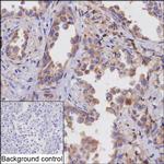 PTGDS Antibody in Immunohistochemistry (Paraffin) (IHC (P))