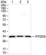 PTGDS Antibody in Western Blot (WB)