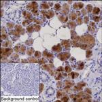GCDFP-15 Antibody in Immunohistochemistry (Paraffin) (IHC (P))
