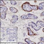 hCG beta-2 Recombinant Rabbit Monoclonal Antibody (K03_1K25)