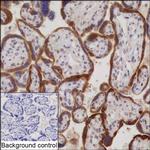 hCG beta-1 Recombinant Rabbit Monoclonal Antibody (K03_1J44)