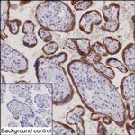 CGA Recombinant Rabbit Monoclonal Antibody (K03_1K09)