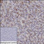 Complement C6 Recombinant Rabbit Monoclonal Antibody (K03_1J33)