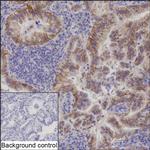 ErbB2 (HER-2) Recombinant Rabbit Monoclonal Antibody (K01_3M21)