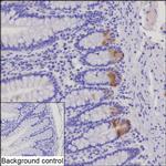 Lysozyme Recombinant Rabbit Monoclonal Antibody (K03_1J92)