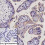 CSF3R Recombinant Rabbit Monoclonal Antibody