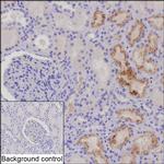 IGFBP6 Recombinant Rabbit Monoclonal Antibody (K03_1J88)